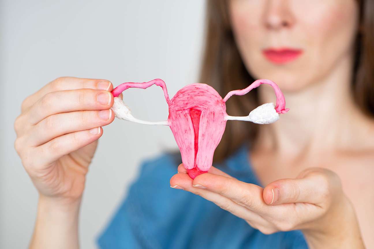 Endometriose – alles Wichtige im Überblick